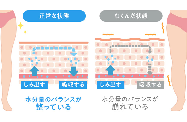 夏にむくみやすくなる原因とは？